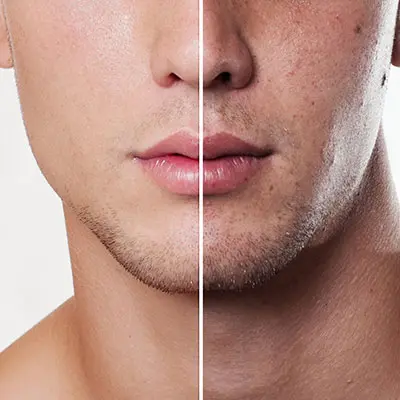 Dermatologist St Petersburg FL