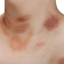 Dermatologist in Largo