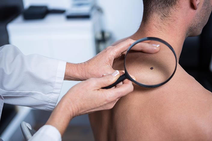 basal cell skin cancer