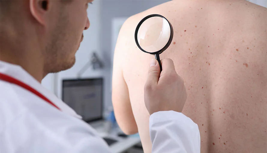 Mohs Surgery St. Petersburg