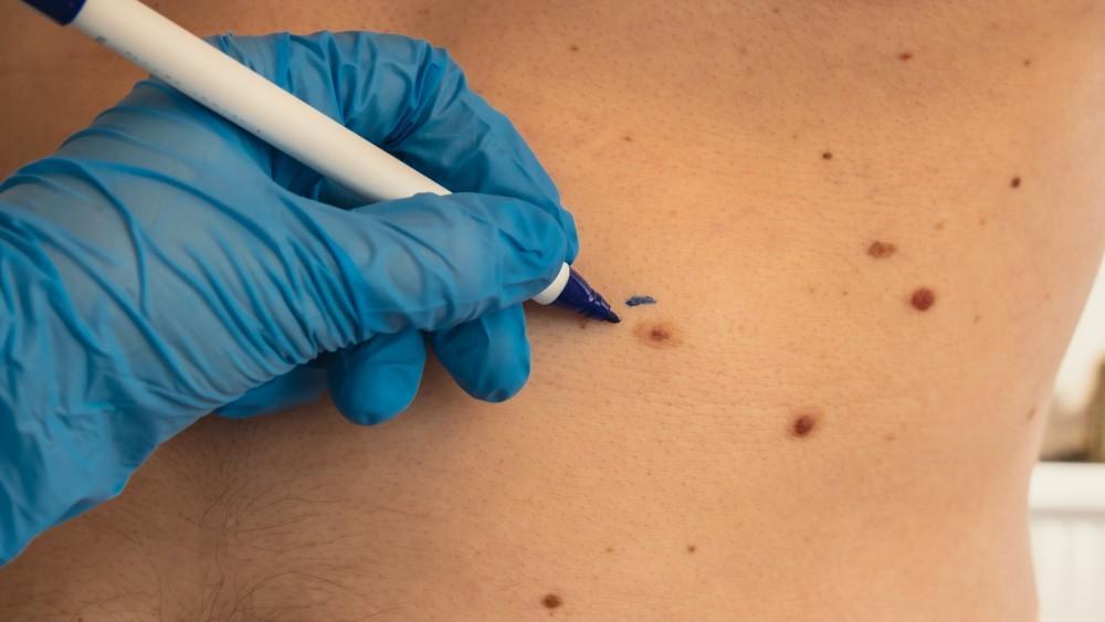 Mohs Dermatology Doctors