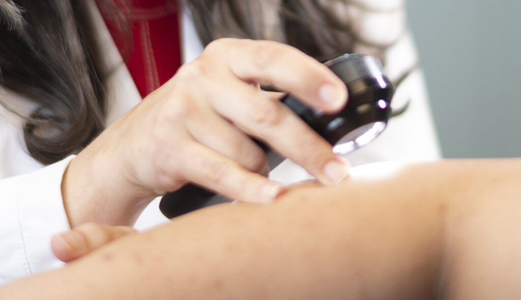 Treatments for Skin Cancer