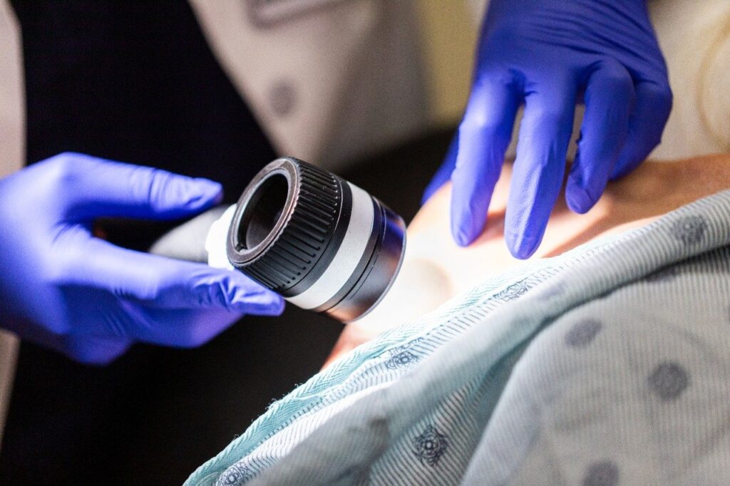 Treatments for Skin Cancer