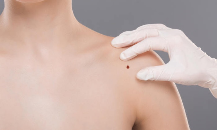 Mohs Dermatology Doctors