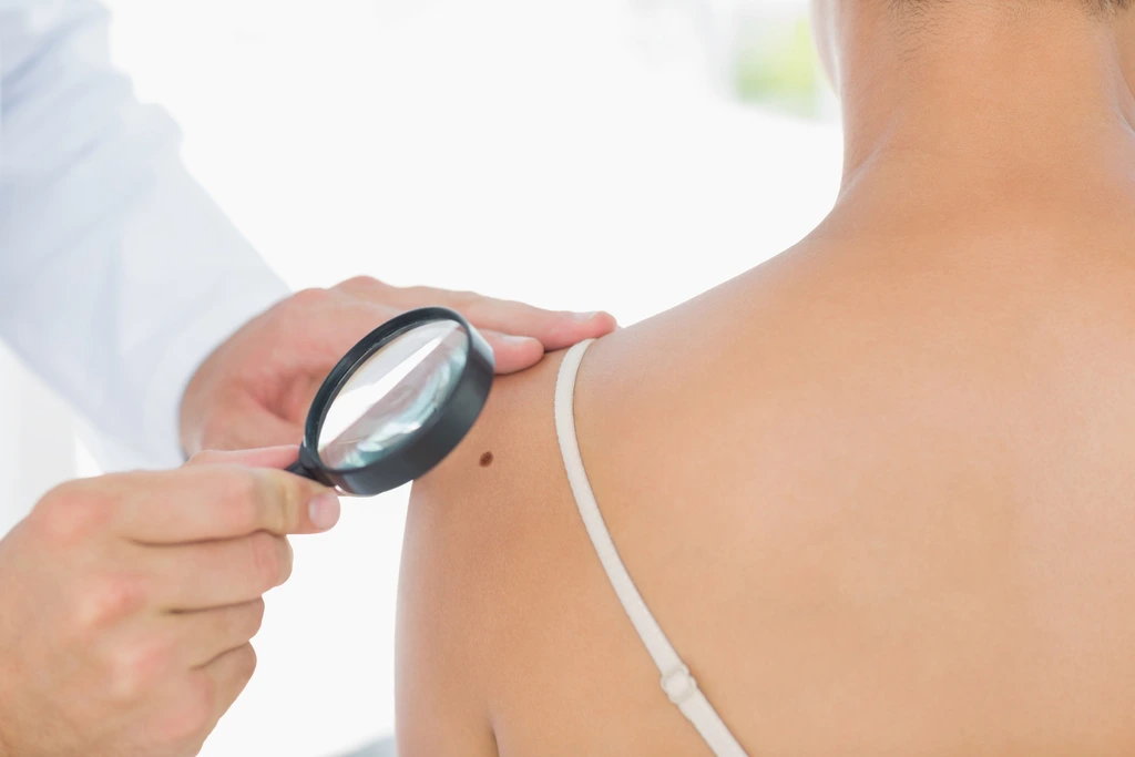 Skin Cancer Alternative Treatment