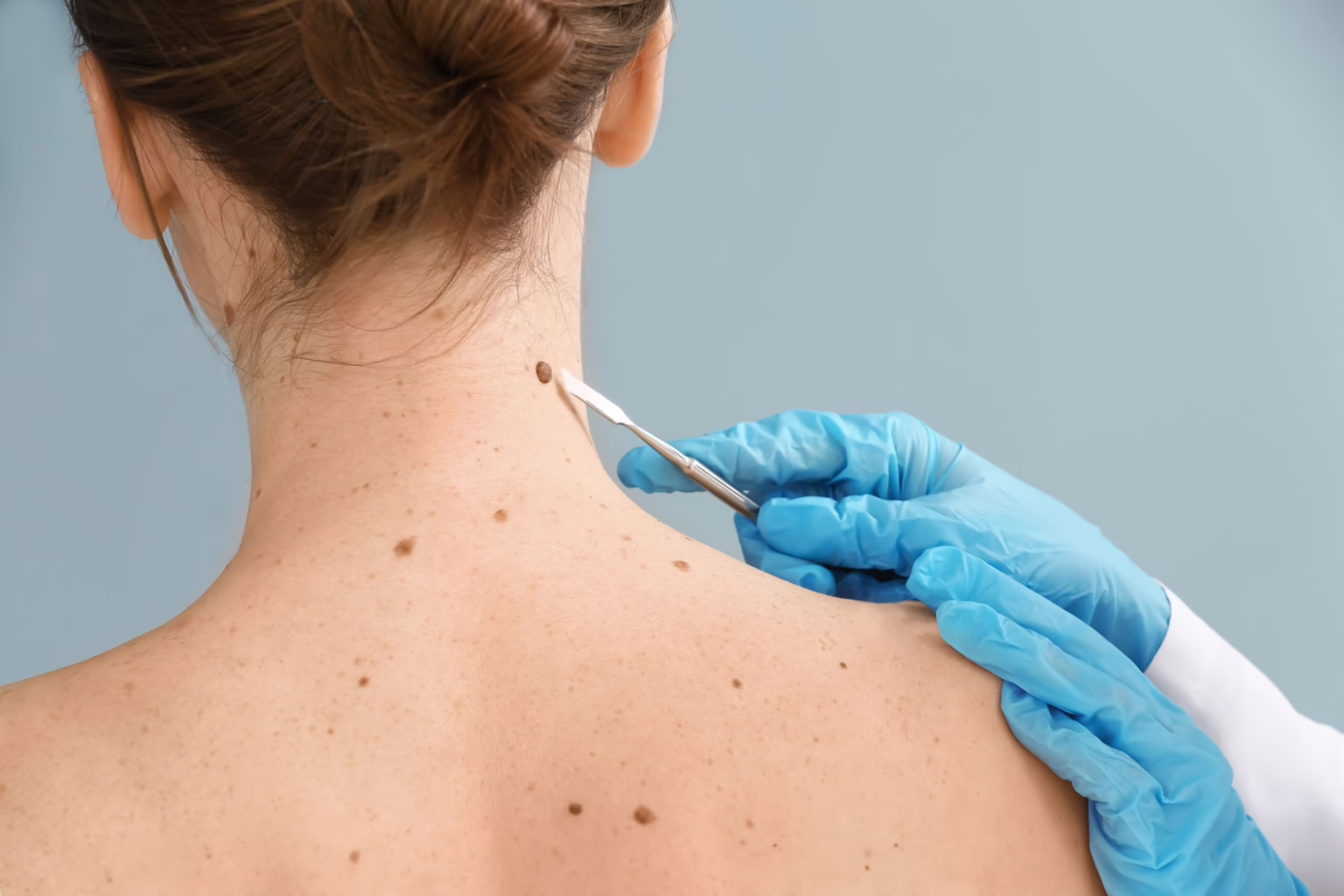 Skin Cancer Specialists